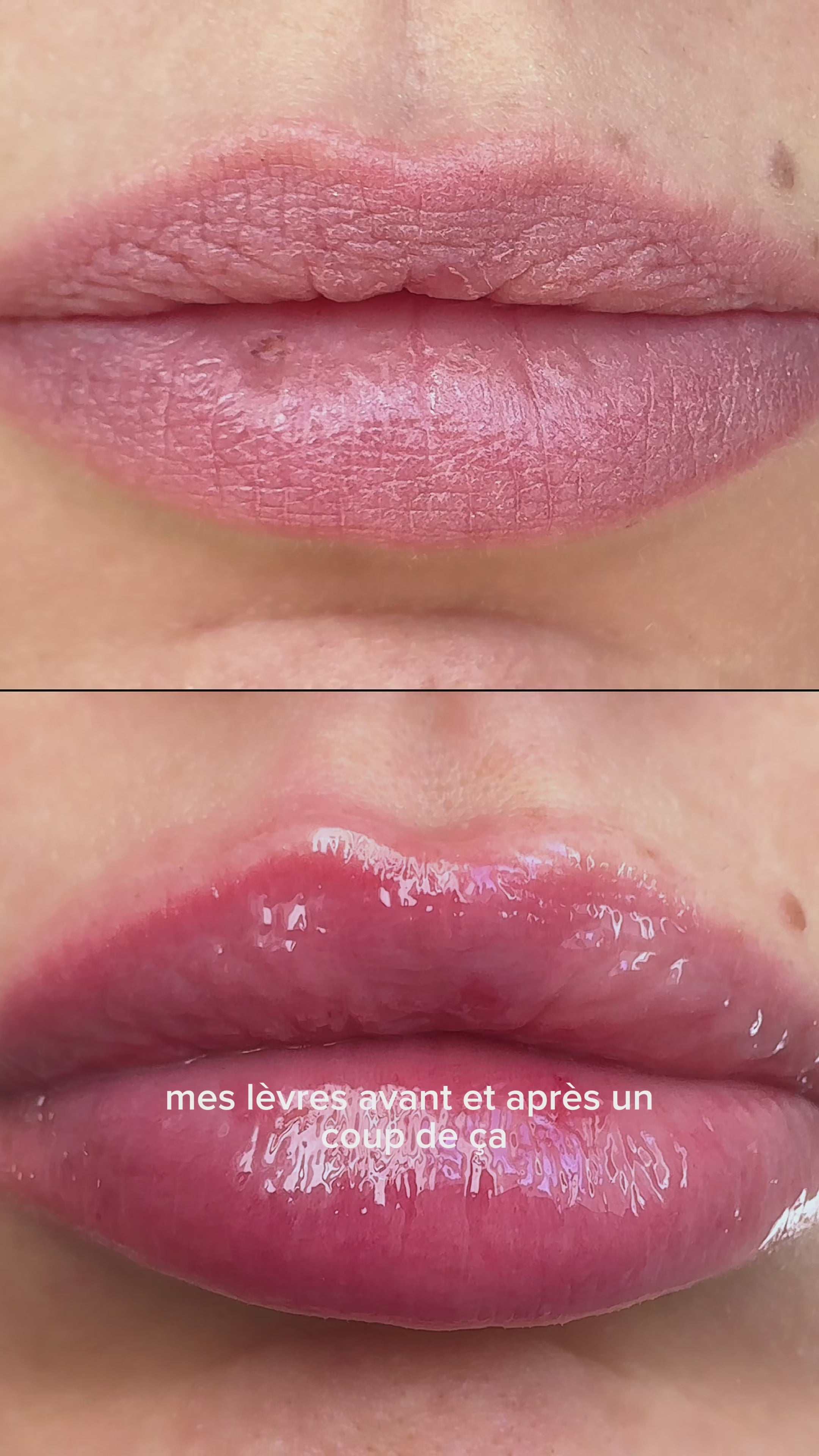 Charger la vidéo : Vidéo avant après du Lip Plumper Adnabella montrant le volume et l'hydratation des lèvres.